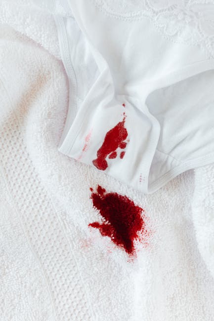 Close-up of a white fabric surface, possibly a bed sheet or towel, exhibiting a fresh bloodstain and a blood smear near a white piece of clothing. The clothing appears to be a shirt or blouse made of cotton or a similar material, with part of a lace or embroidered detail visible. The scene is well-lit, emphasizing the contrast between the clean white fabric and the vivid red stain, indicating the need for deep surface cleaning and stain removal. This image reflects the importance of prompt stain treatment and sanitisation in domestic or commercial settings. The focus on the stained fabric highlights the expertise of Carpet Cleaners Islington in providing same day carpet cleaning and stain removal services for urgent situations within residential or commercial environments.